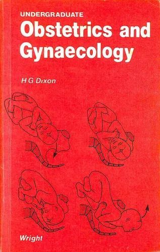 Undergraduate Obstetrics and Gynaecology