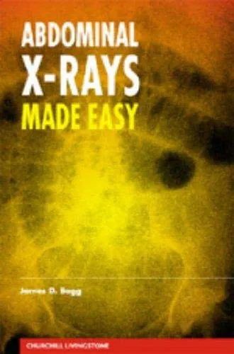 Abdominal X-rays Made Easy