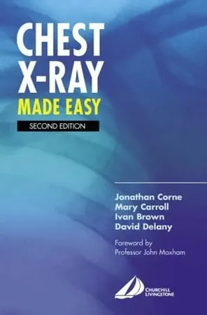 Chest X-ray Made Easy