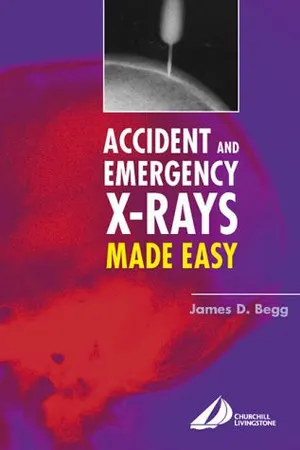 Accident and Emergency X-rays Made Easy