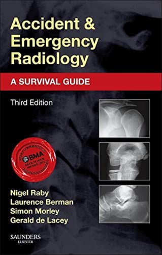 Radiología de urgencias y emergencias: una guía de supervivencia