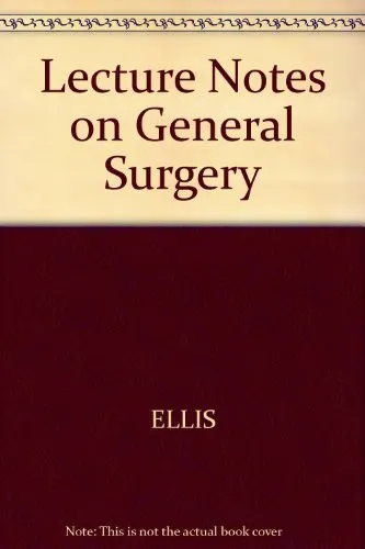 Lecture Notes on General Surgery