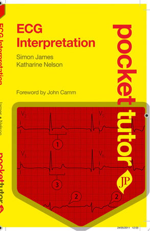 ECG Interpretation